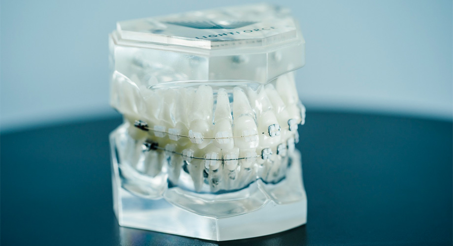 3-D print fully customized tooth moving tools