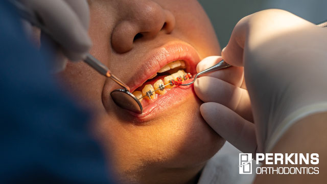 Orthodontic emergencies are a challenging but solvable problem for patients.